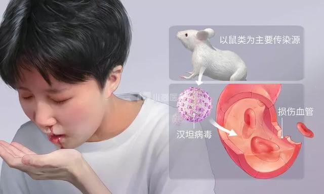 西安为什么高发出血热(西安出现多例出血热)(6)