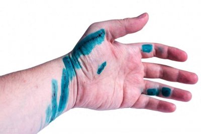 ​不小心被猫抓出了血痕，是否需要打狂犬疫苗？