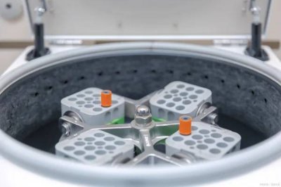 ​核酸检测结果一直没出来怎么回事（核酸检测结果24小时还没出来怎么办）