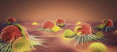 ​姚贝娜是名人、条件好，术后却只活了三年多，也许跟3个原因有关