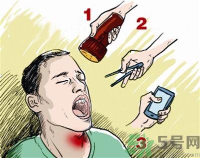 鱼刺卡喉喝醋可以治疗吗？鱼刺卡喉喝醋好不好？