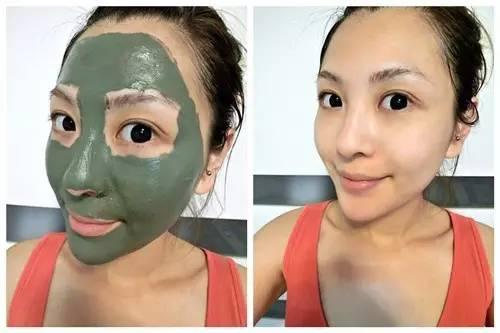 用什么护肤可以去红血丝（手把手教你如何去除红血丝）(9)