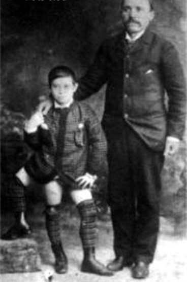 老照片纪录：拥有三条腿，两个生殖器官的男人