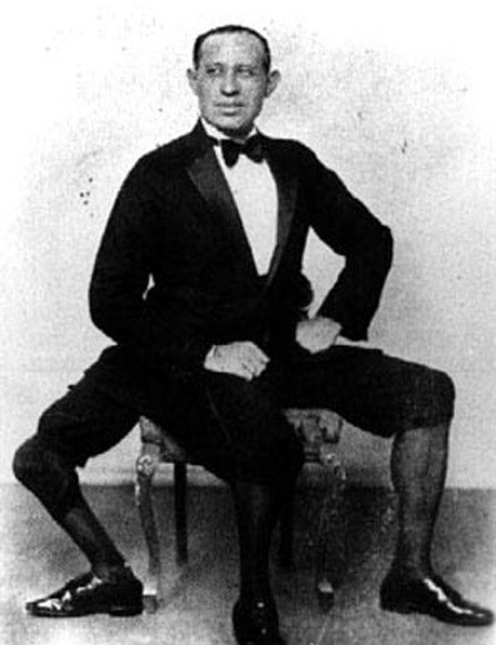 老照片纪录：拥有三条腿，两个生殖器官的男人