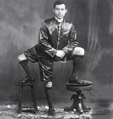 老照片纪录：拥有三条腿，两个生殖器官的男人