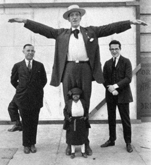 老照片纪录：拥有三条腿，两个生殖器官的男人