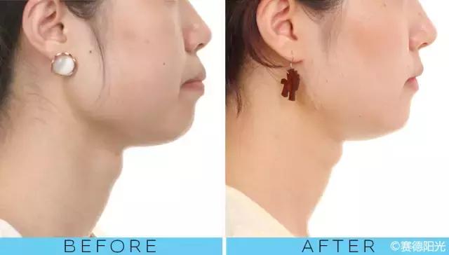 整容后变好看的五位女明星（那些默默变美的明星们不是整容）(17)