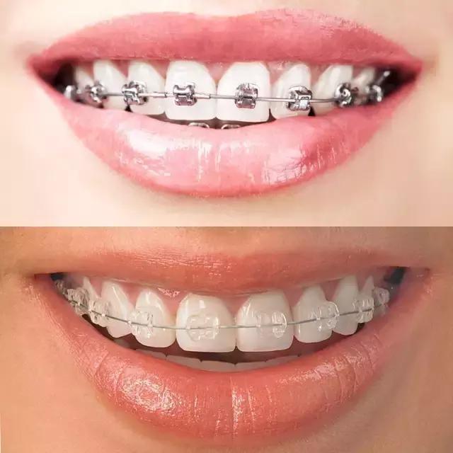 整容后变好看的五位女明星（那些默默变美的明星们不是整容）(23)