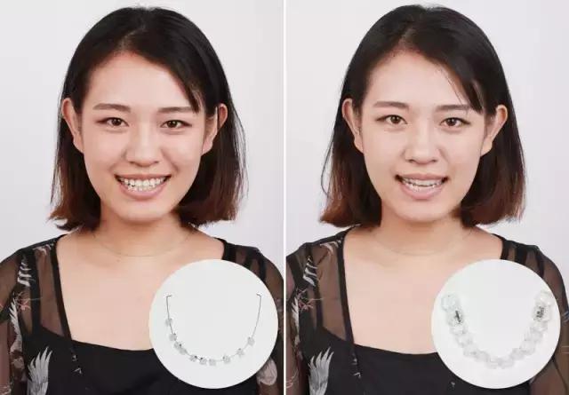 整容后变好看的五位女明星（那些默默变美的明星们不是整容）(26)