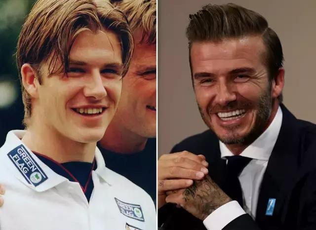 整容后变好看的五位女明星（那些默默变美的明星们不是整容）(12)