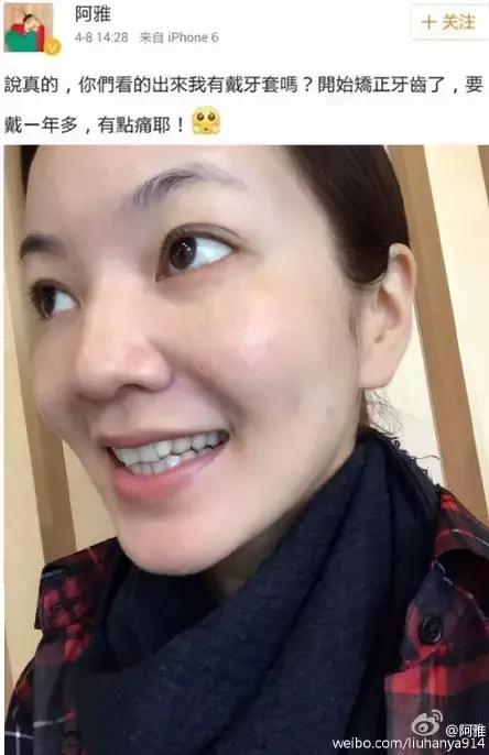 整容后变好看的五位女明星（那些默默变美的明星们不是整容）(4)